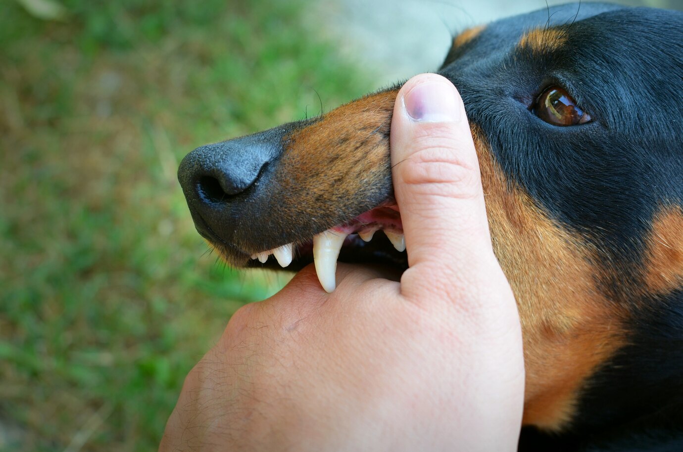perro-vicioso-mostrando-dientes-mordiendo-mano_342744-788.jpg